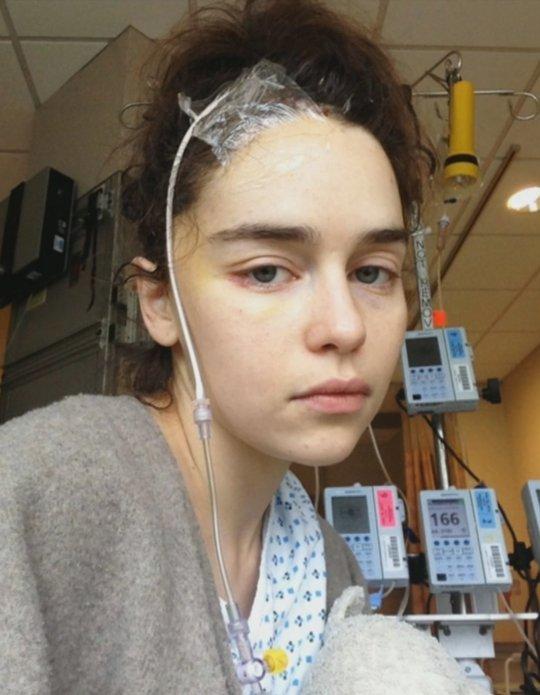 Actrița Emilia Clarke, imagini de pe patul de spital, de când a suferit primul anevrism cerebral: ”I-am rugat pe medici să mă lase să mor!”