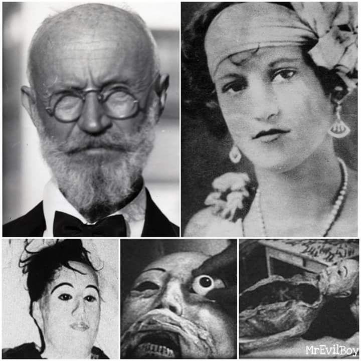 Povestea medicului care s-a îndrăgostit nebunește de o pacientă muribundă! ”A readus-o la viață” cu ghips, sârmă și ochi de sticlă și a trăit lângă ea șapte ani