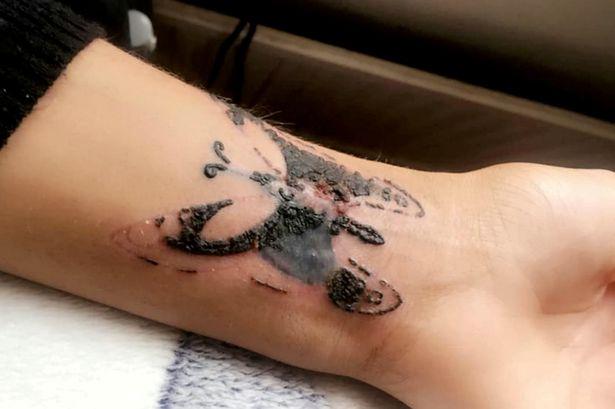 Șocant! Drama trăită de o fată care a vrut să-și facă un tatuaj la un tatuator cu prețuri mai mici: "Am fost la un pas de moarte"