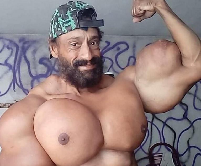 „Se sinucide încet, pentru nimic”. Un culturist care își riscă viața pentru a-și mări mușchii șochează internetul – Foto