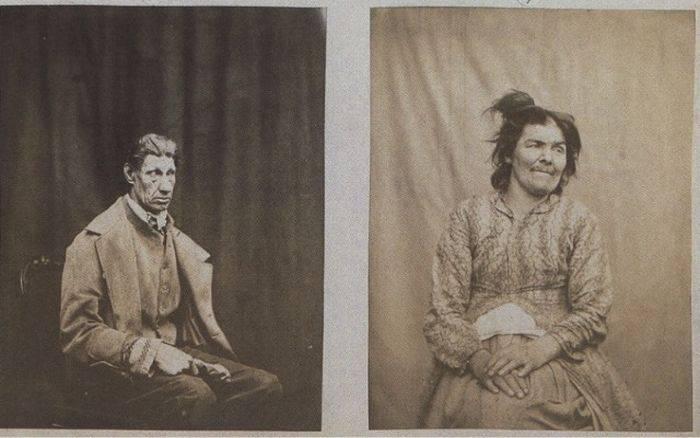 Primul spital de psihiatrie din lume, un adevărat Iad pentru bolnavi! Pacienții, ținuți în lanțuri, bătuți crunt și înfometați