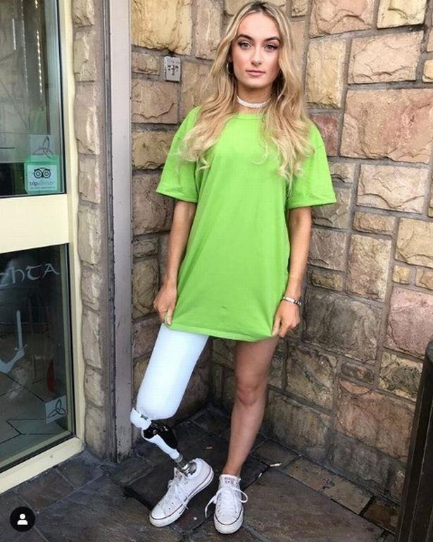 A rămas fără un picior, după o luptă cu o boală cumplită. Acum, este model și arată tuturor că orice trup este perfect