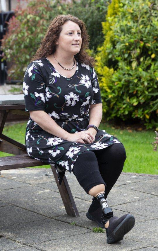 Și-a implorat medicii să îi amputeze piciorul! Drama femeii a început în momentul în care a scăpat o sticlă de parfum