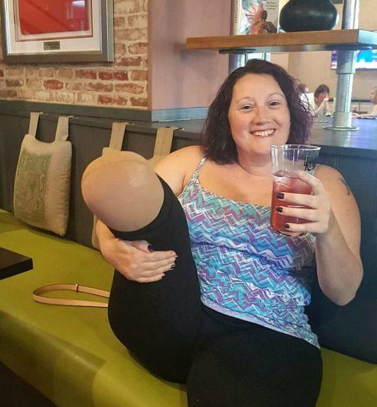 Și-a implorat medicii să îi amputeze piciorul! Drama femeii a început în momentul în care a scăpat o sticlă de parfum