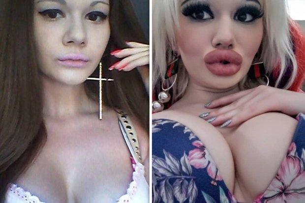 Era o tânără superbă, până când s-a hotărât să se transforme într-o… Barbie! Cum a ajuns să arate după 15 operații, făcute într-un an - Foto