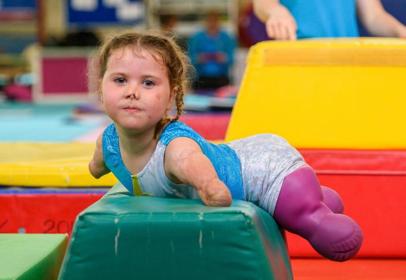 A rămas fără mâini și picioare înainte să împlinească un an. I le-a furat o boală cumplită. Astăzi, micuța este un exemplu de ambiție