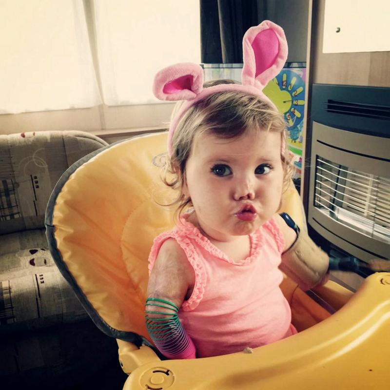 A rămas fără mâini și picioare înainte să împlinească un an. I le-a furat o boală cumplită. Astăzi, micuța este un exemplu de ambiție