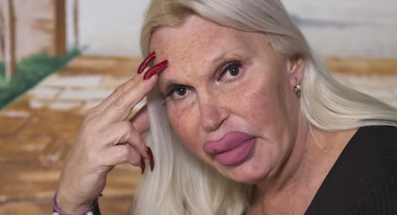 În căutarea perfecțiunii, și-a făcut aproape 200 de operații estetice și a cheltuit o avere! Acum, îi este rușine să mai iasă din casă