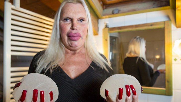 În căutarea perfecțiunii, și-a făcut aproape 200 de operații estetice și a cheltuit o avere! Acum, îi este rușine să mai iasă din casă