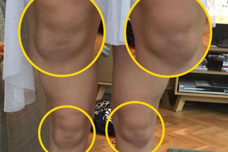 O mamă a pus poza fiicei pe internet și toți au râs cu lacrimi! Ce detaliu au văzut la genunchi