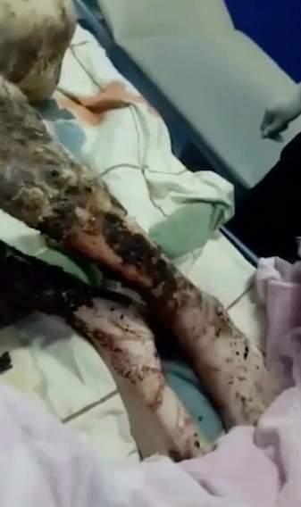 Adevărul din spatele omului ținut "ostatic" de un urs! " Îmi doream să mor..."