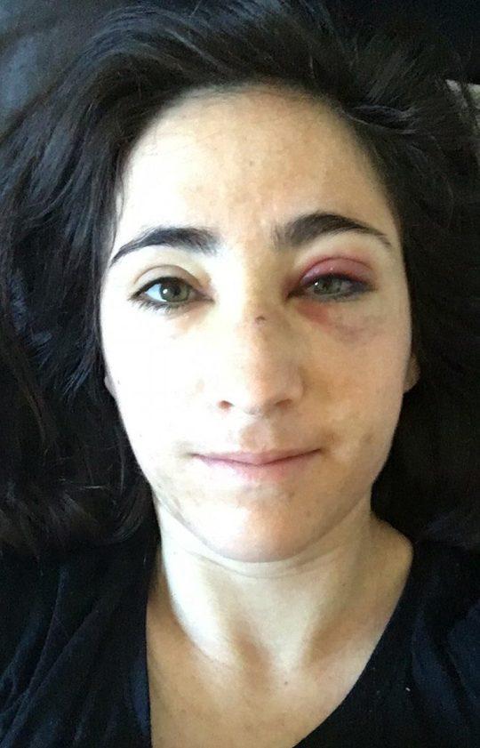 Bătute și umilite, într-un autobuz, pentru că au refuzat să se sărute în fața unor bărbați. După aproape două luni, atacatorii au fost găsiți