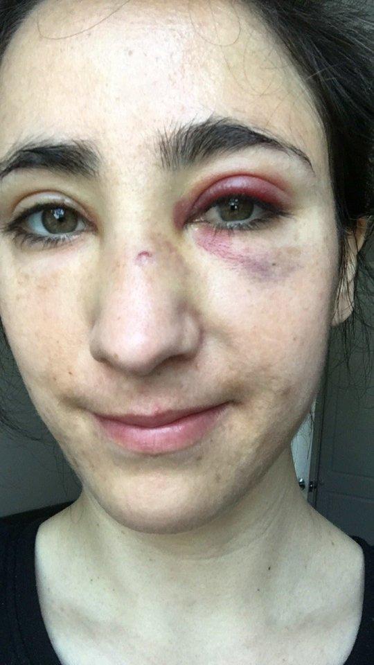 Bătute și umilite, într-un autobuz, pentru că au refuzat să se sărute în fața unor bărbați. După aproape două luni, atacatorii au fost găsiți