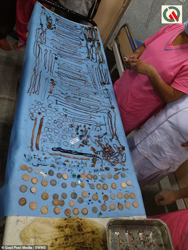 A înghițit bijuterii în valoare de 59.000 de euro! Când i-au deschis stomacul, medicii au fost șocați! Atenție, imagini ce vă pot afecta emoțional! – Foto
