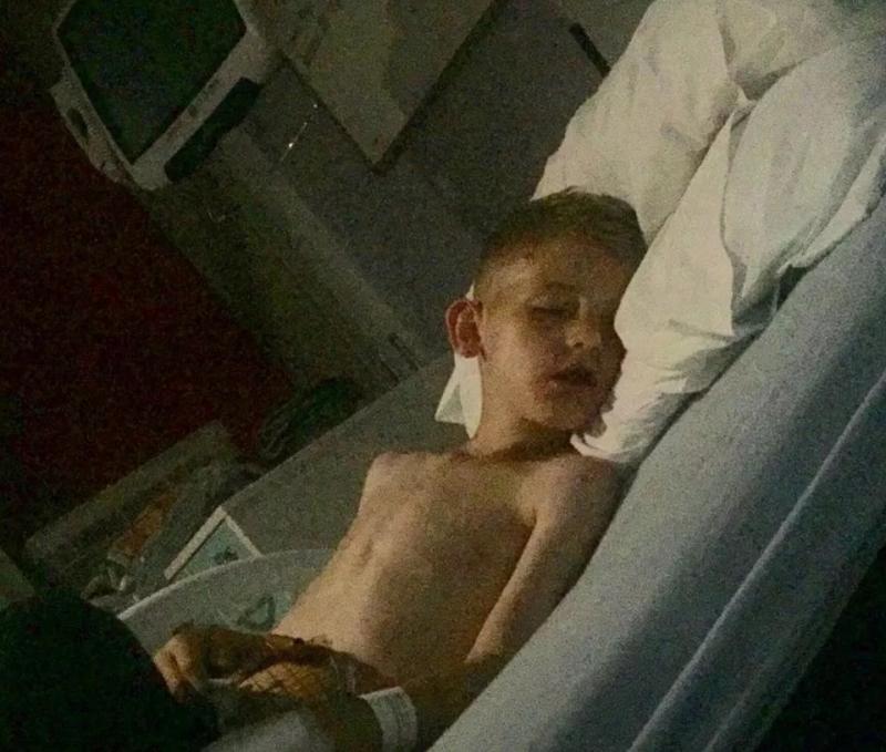 Un copil de șase ani la un pas de moarte după ce i-a rămas limba blocată într-o sticlă de apă. Zece doctori și patru specialiști i-au salvat viața
