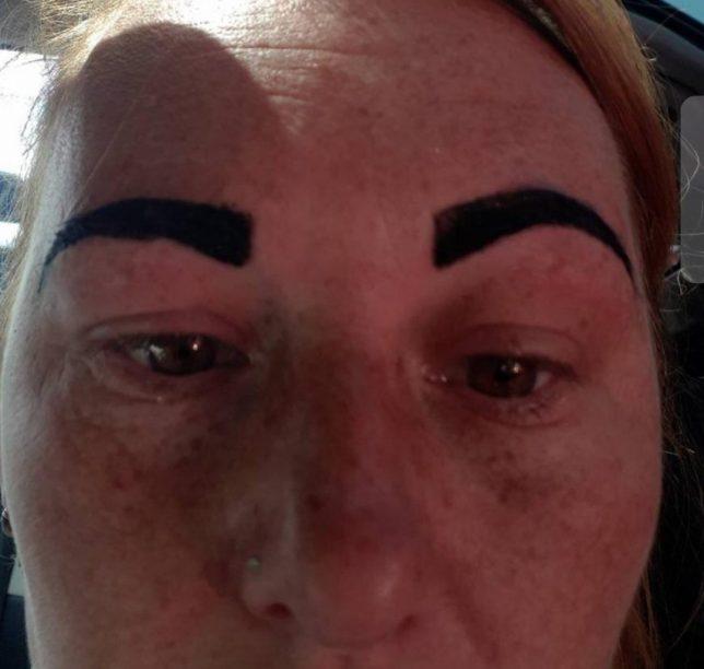 „Și-a bătut joc de mine! Îmi e rușine să mai ies din casă!” O femeie a plecat desfigurată de la salonul de înfrumusețare - Foto