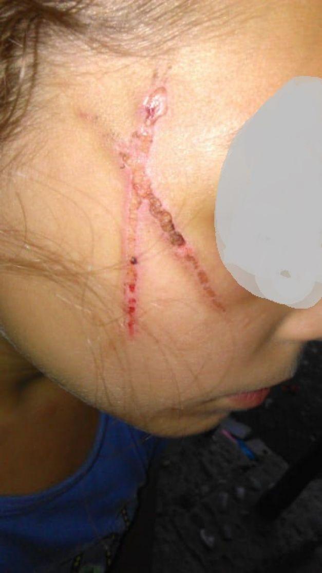 FOTO Imagini terifiante. Bătute cu biciul fără milă! Fete de șase, opt și unsprezece ani agresate de propriul tată!