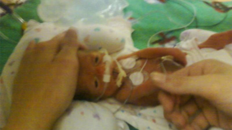 Copilul minune s-a născut la doar 23 de săptămâni și are 400 de grame. „Sunt atât de mândră de el”