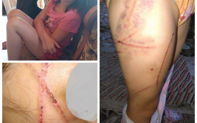 Monstru, nu tată! Cine este bărbatul din Arad care și-a bătut fetele cu biciul, pentru ceva ce au făcut în joacă. Imagini ce vă pot afecta emoțional! Foto