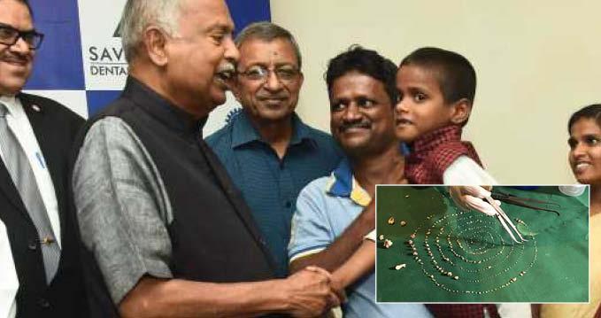 El este băiatul cu 526 de dinți! Doctorii s-au uimit când i-au văzut gura