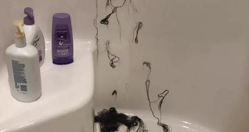 Și-a dat cu balsam pe păr, dar a ieșit cheală din baie! Produsul e folosit de milioane de femei