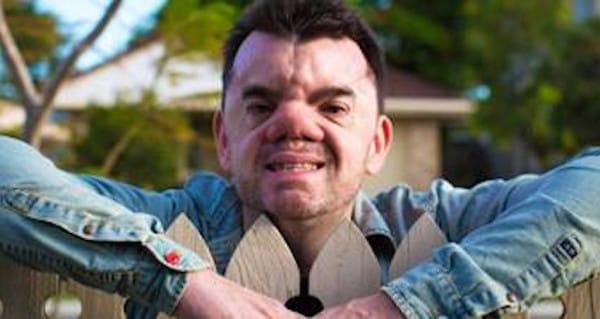 Abandonat la naștere pentru că era prea urât! "Pedeapsă de la Dumnezeu? Am născut un monstru!" Cine este copilul a cărei viață este unică