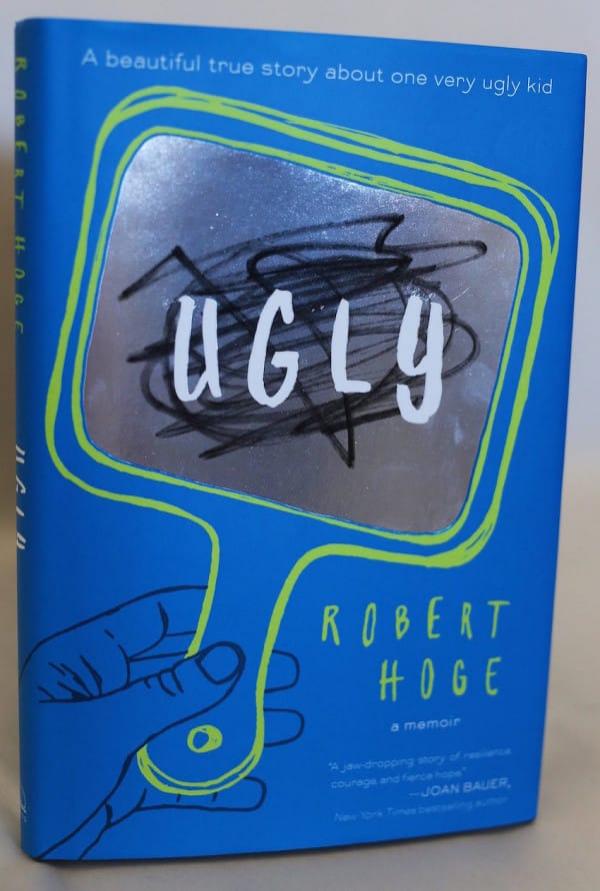 Abandonat la naștere pentru că era prea urât! "Pedeapsă de la Dumnezeu? Am născut un monstru!" Cine este copilul a cărei viață este unică