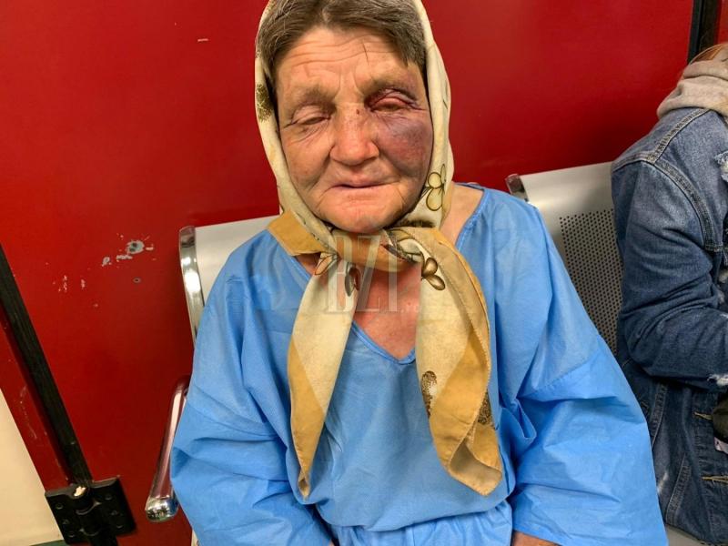 O bătrână a fost bătută cu bestialitate în gara din Iași, femeia își aștepta nepoata. „Au început, maică, să mă bată cu pumnii și picioarele, să țipe și să râdă”