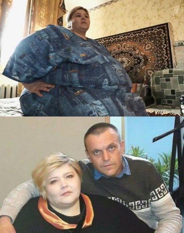 O femeie de 270 de kilograme este forțată să slăbească, după ce a dărâmat tavanul vecinilor de sub ea
