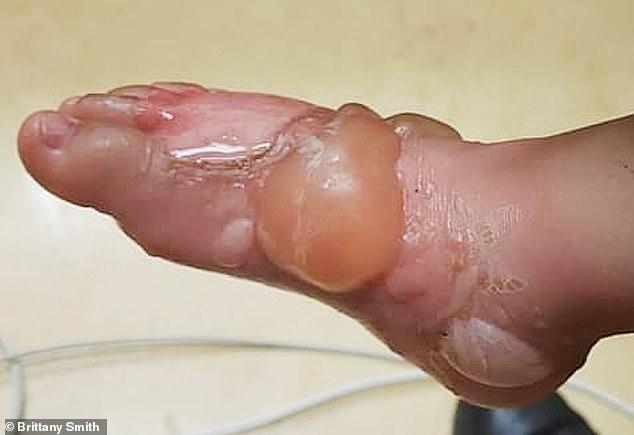 Monstru, nu bunică! Și-a băgat nepoata cu picioarele în apă clocotită, drept pedeapsă! Scuza ei este de necrezut! Atenție, imagini tulburătoare! Foto