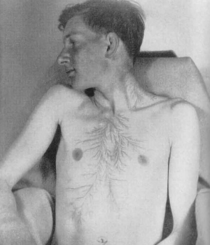 Imagini cu puternic impact emoțional! Așa arată trupurile lovite de fulgere!