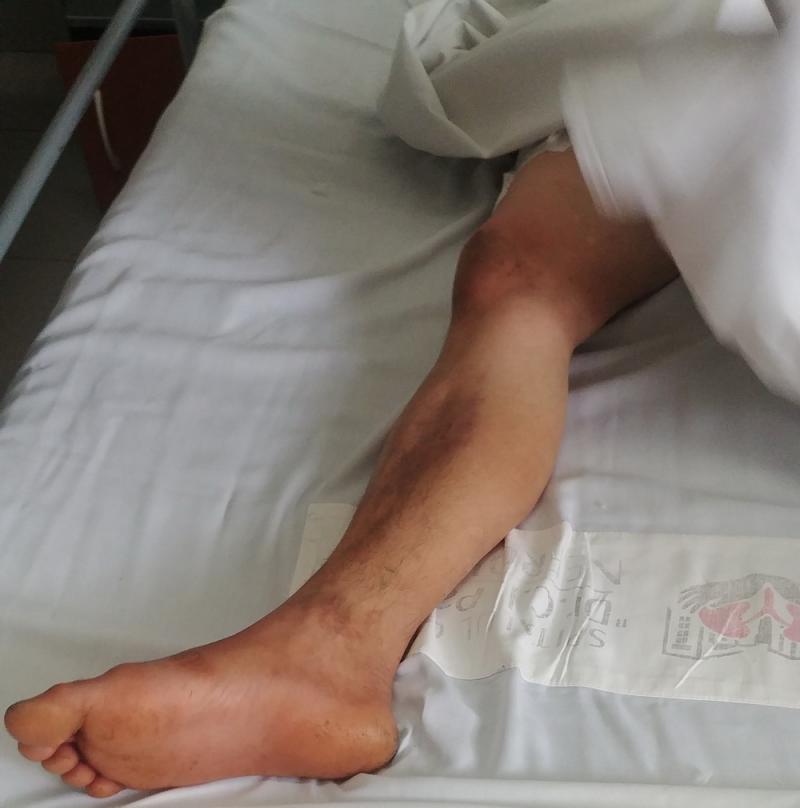 A fost găsită beată și avea rănile pline cu viermi. O femeie a fost transportată de urgență la spital din Iași - FOTO