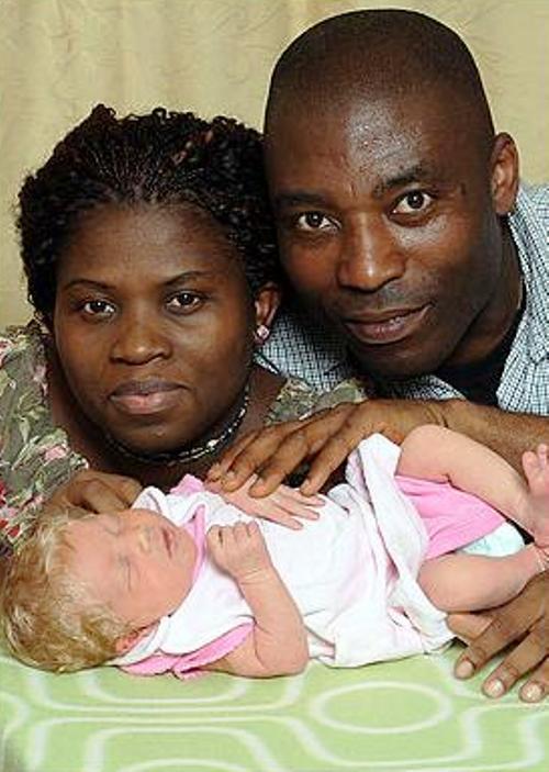 "Este inexplicabil! Am stat ore în șir și am privit copilul!". Nașterea unei fetițe a șocat până și geneticienii! Tatălui îi este greu să creadă că soția ar fi făcut ceva