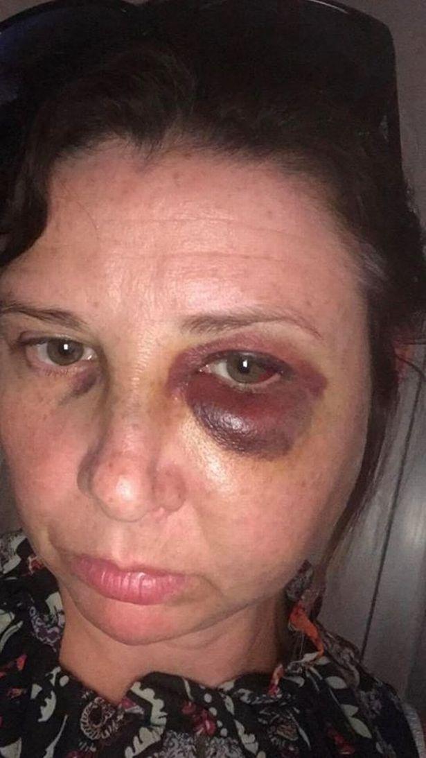 A fost martor atunci când mama lui a fost bătută cu sălbăticie de tatăl lui! Cuvintele pe care le-a spus băiețelul de trei ani îți rup sufletul