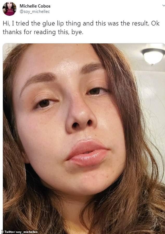 Practică bizară de mărire a buzelor care pune în pericol viața adolescentelor