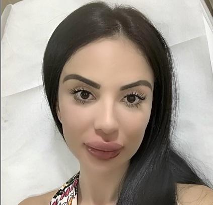 O tânără a făcut zeci de operații ca să arate sexy, dar rezultatul e șocant! Nimeni nu se poate uita la ea | FOTO