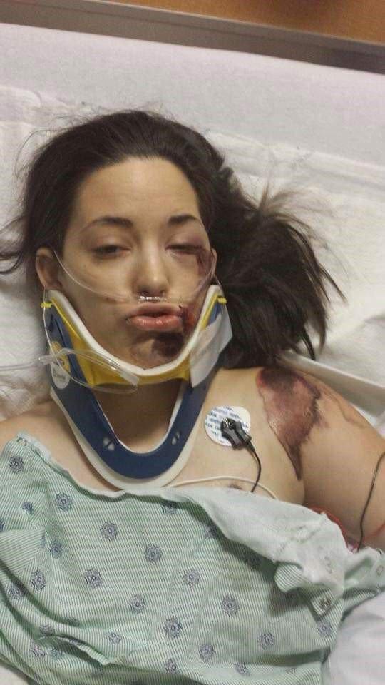 Pe patul de spital, a fost pusă să aleagă între o viață normală și bebelușul din pântecul ei: „Piciorul meu nu mă definea ca om”