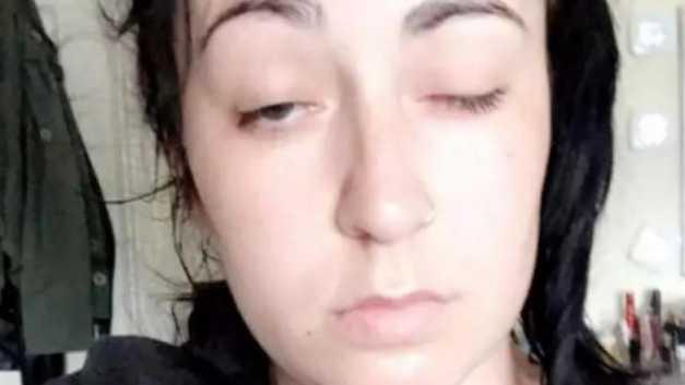 Salvată de la moarte de o fotografie. Medicii au identificat imediat o hemoragie cerebrală masivă