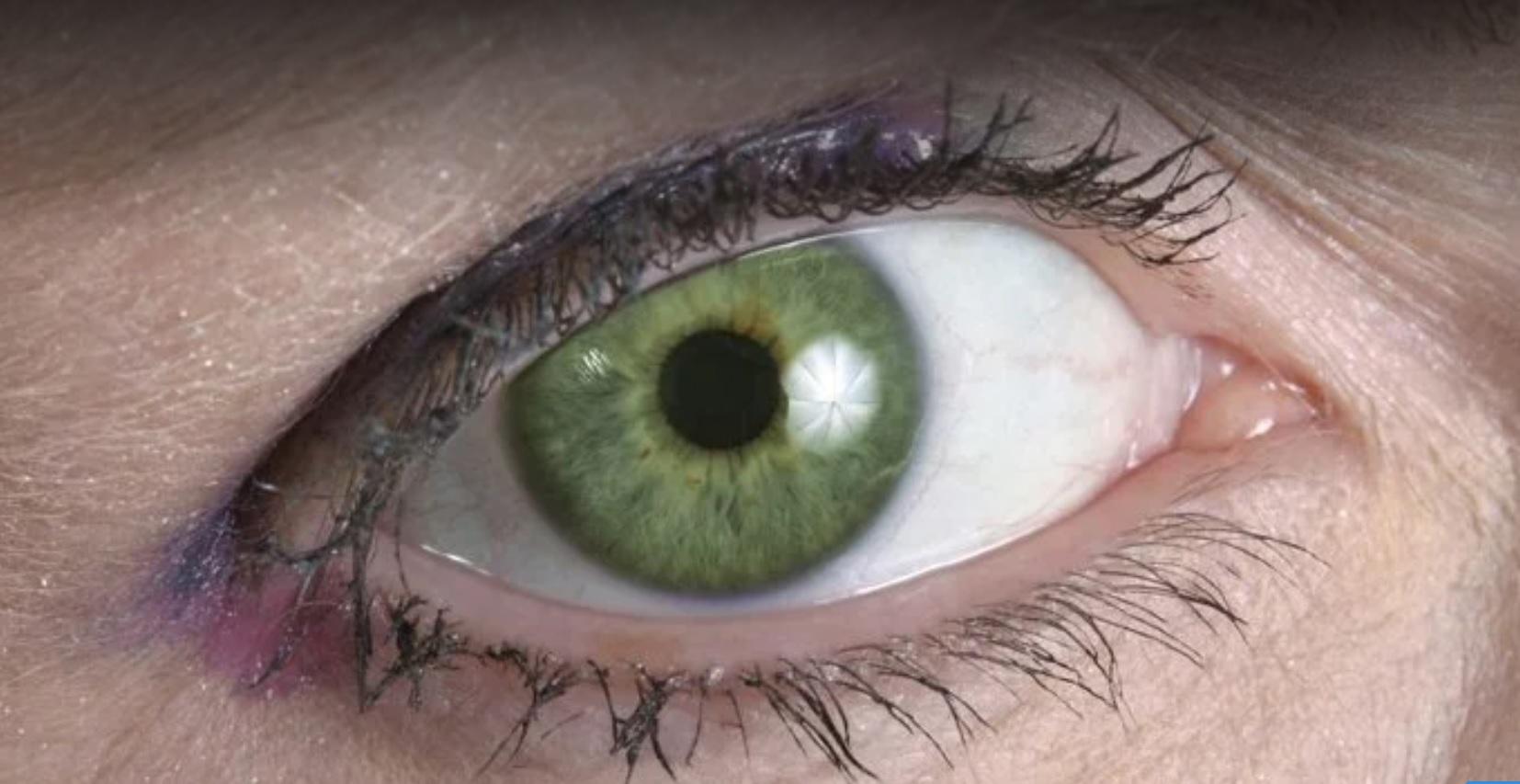 Cele Opt Culori De Ochi Rare Care Există In Lume Află De Ce Ai