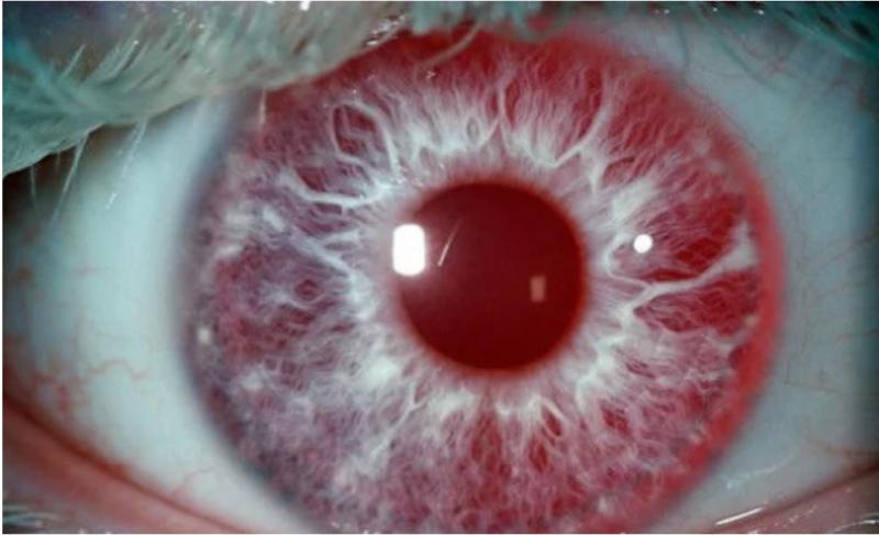 Cele opt culori de ochi rare, care există în lume. Află de ce ai tăi nu sunt așa