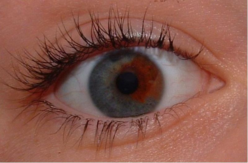 Cele opt culori de ochi rare, care există în lume. Află de ce ai tăi nu sunt așa