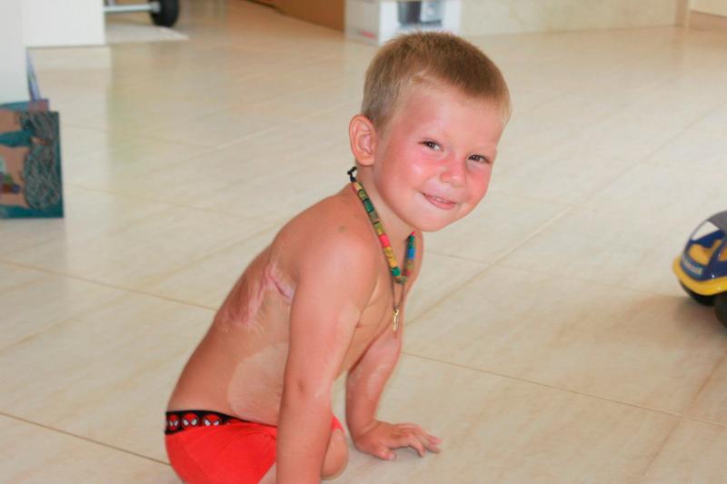 Maxim nu a apucat să facă niciun pas. Când era bebeluș, un incendiu i-a furat ambele picioare. Astăzi, puștiul visează să participe la Jocurile Paralimpice