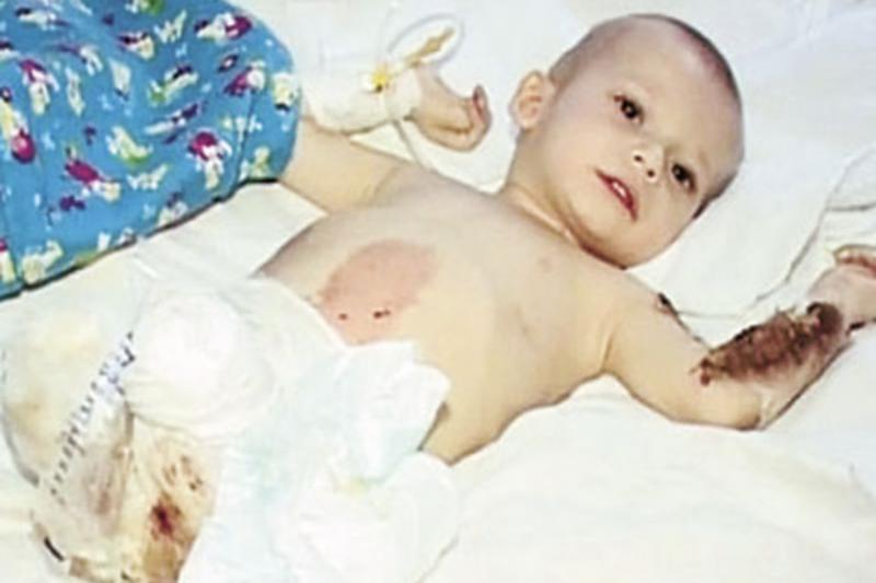 Maxim nu a apucat să facă niciun pas. Când era bebeluș, un incendiu i-a furat ambele picioare. Astăzi, puștiul visează să participe la Jocurile Paralimpice