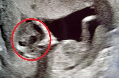 O gravidă a mers să facă ecografie, dar a trăit un șoc uriaș! Ce imagine sinistră a apărut | FOTO