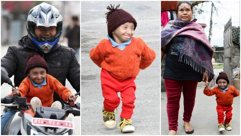 Cel mai scund bărbat mobil din lume a murit, la 27 de ani! Măsura 67 de centimetri! Care au fost marile lui pasiuni. „Când s-a născut, îmi încăpea în palmă” – FOTO