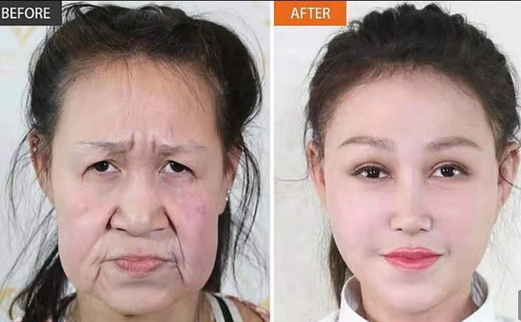 Arăta ca o bunică, la 15 ani, iar acum arată ca o păpușă! A primit o FAȚĂ nouă, de 65.000 de euro! „Doar porumbeii îmi țineau companie, pentru că nu mă vedeau urâtă!” – FOTO