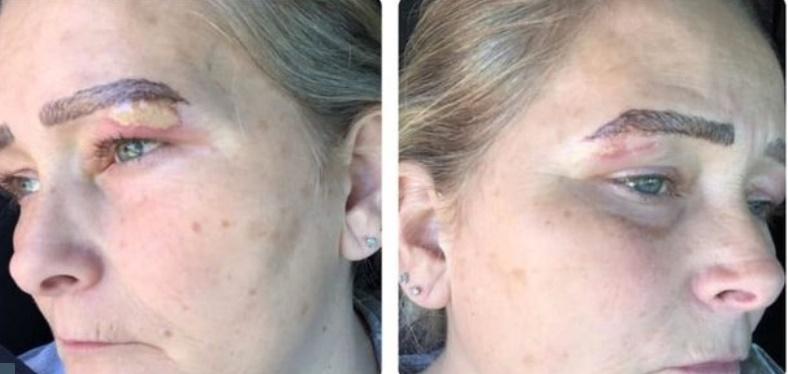 O femeie a vrut să-și tatueze sprâncenele și a devenit „vedetă” peste noapte! Tot internetul râde de ea