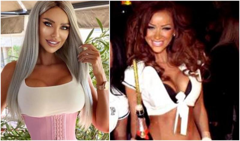 Vedete din România înainte și după operații estetice. Ele au recunoscut că au apelat la chirurgia plastică