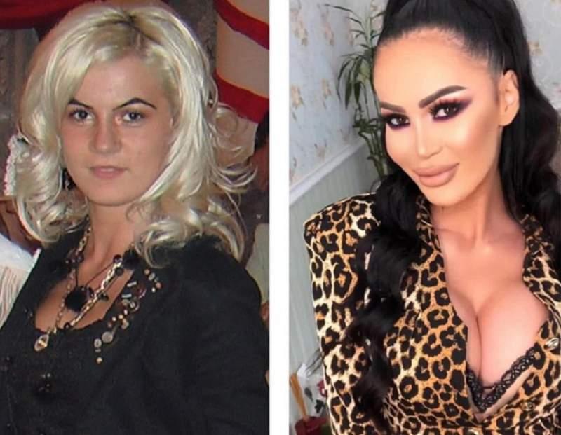 Vedete din România înainte și după operații estetice. Ele au recunoscut că au apelat la chirurgia plastică
