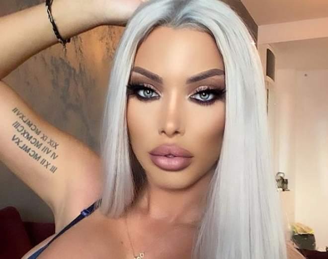 Vedete din România înainte și după operații estetice. Ele au recunoscut că au apelat la chirurgia plastică